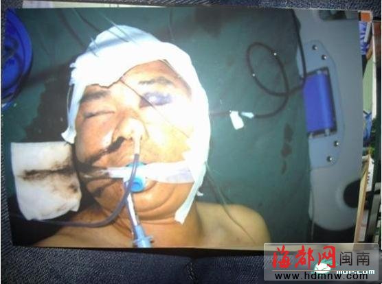 晋江再现药家鑫：高官子弟车祸后行凶伤人致死